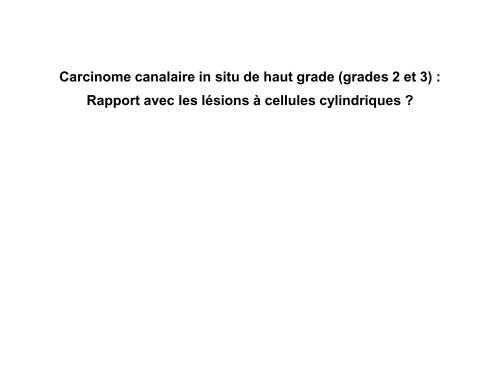 Carcinome canalaire in situ