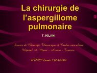 La chirurgie de l'aspergillome pulmonaire(T. KILANI)