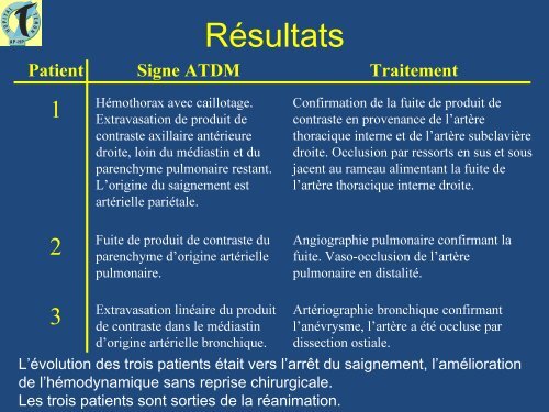 Hémothorax postopératoire : apport de l'imagerie