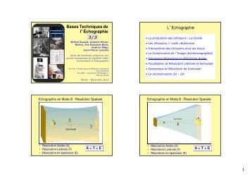 MD Bases Echographie DIUE 2012A3sur3 - Ultrasonographie ...