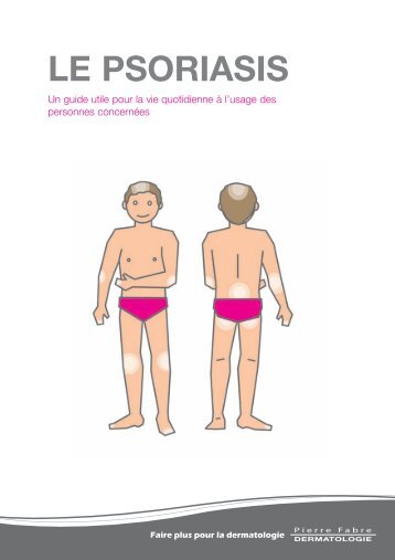 Atopitchesky la dermatite à lallergie le traitement