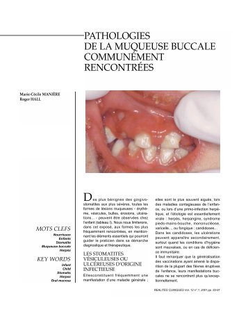 pathologies de la muqueuse buccale communément rencontrées