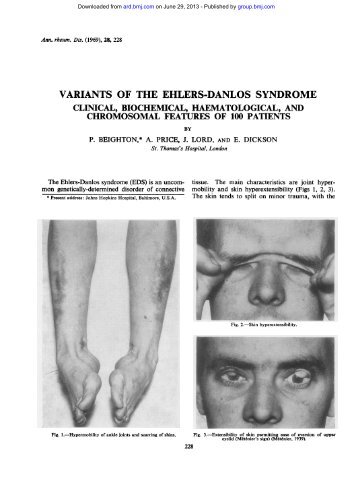 variants of the ehlers-danlos syndrome - Annals of the Rheumatic ...