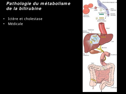 Pathologie du Foie et des voies biliaires - epathologies