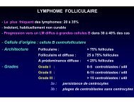 LYMPHOME FOLLICULAIRE