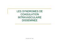 Les syndromes de CIVD