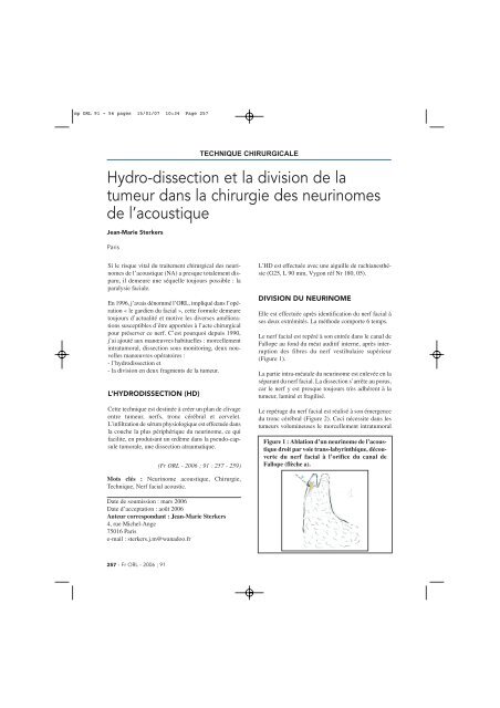 Hydro-dissection et la division de la tumeur dans la chirurgie des ...