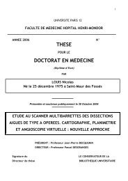 THESE DOCTORAT EN MEDECINE