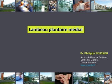 Lambeau plantaire médial - e-plastic.fr