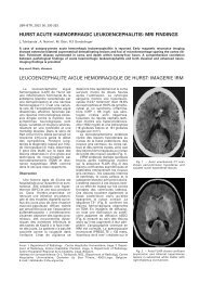 hurst acute haemorrhagic leukoencephalitis: mri findings ... - rbrs