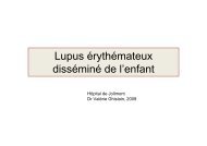 Lupus érythémateux disséminé de lenfant - Mon enfant grandit