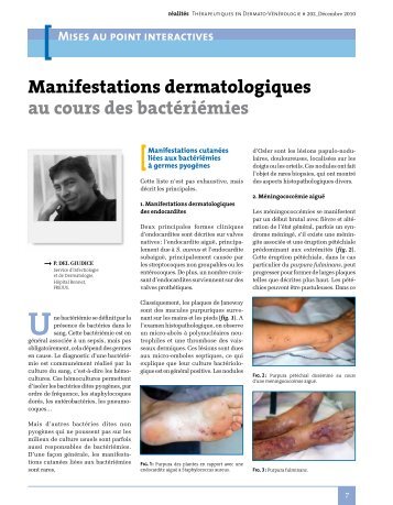 Manifestations dermatologiques au cours des bactériémies