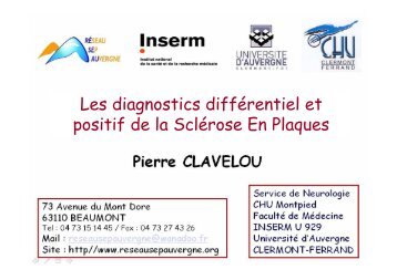 Les diagnostics différentiel et positif de la sclérose en plaques