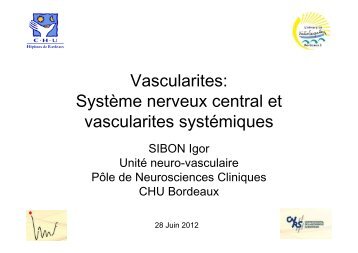 Vascularites : système nerveux central et vascularites systémiques