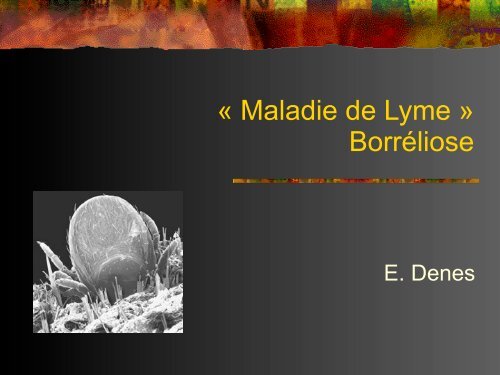 « Maladie de Lyme » Borréliose