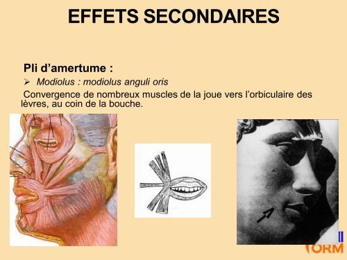 LA TOXINE BOTULIQUE