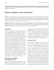 Sclérose en plaques et neuro-acupuncture - Méridiens