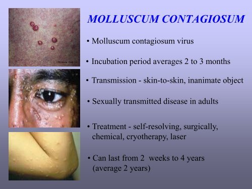 Benign skin tumor ( non – vascular )