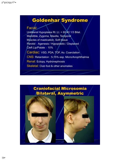 Hypoplasia-Hyperplasia