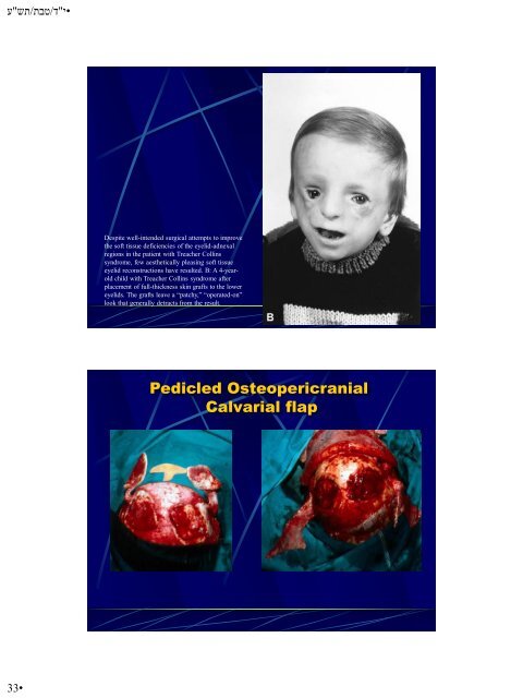 Hypoplasia-Hyperplasia