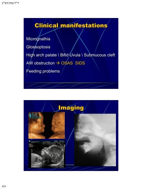 Hypoplasia-Hyperplasia