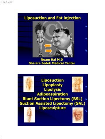 Liposuction and Fat injection Liposuction Lipoplasty Lipolysis ...