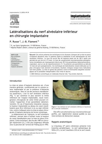 Latéralisations du nerf alvéolaire inférieur en chirurgie implantaire