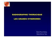 RX THORAX GRANDS SYNDROMES - Club Thorax