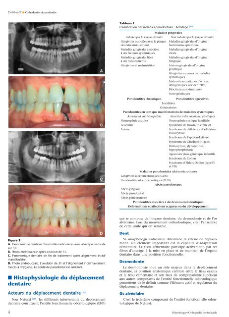 Orthodontie et parodontie - Belbacha Dental