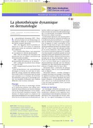 La photothérapie dynamique en dermatologie