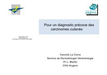 diag carcinomes basocellulaires et épidermoïdes epu 13.01.2011.pdf