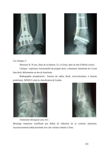 Pierre Sylvain Marcheix - desc orthopedie