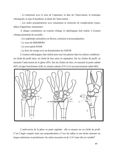 Pierre Sylvain Marcheix - desc orthopedie