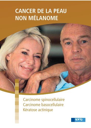 CANCER DE LA PEAU NON MÉLANOME - Laboratoires Spirig
