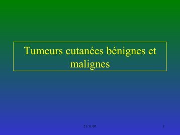 Tumeurs cutanées bénignes et malignes - ammppu