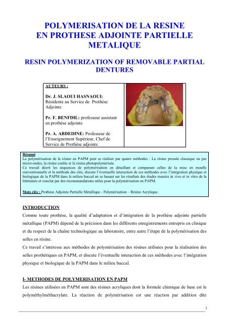 polymerisation de la resine en prothese adjointe partielle metalique