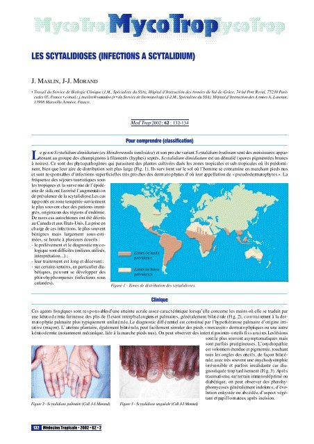 les scytalidioses (infections a scytalidium) - Revue Médecine Tropicale