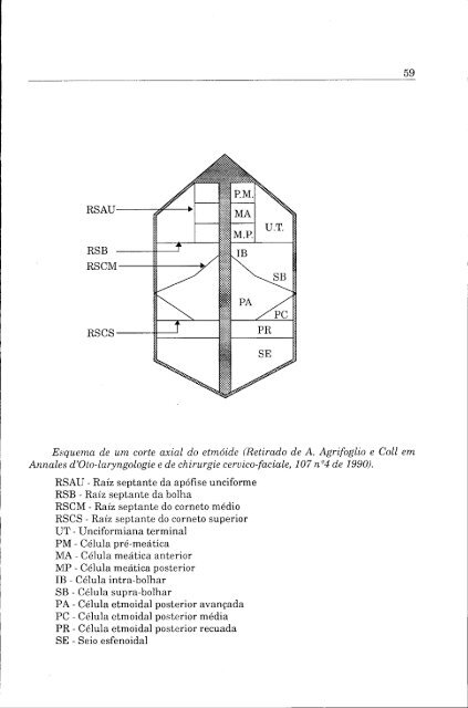 conceitos actuais do tratamento cirúrgico das sinusites crónicas