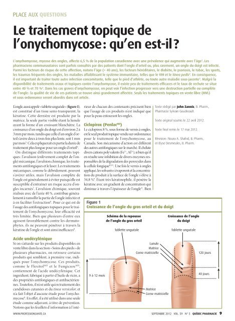 Le traitement topique de l'onychomycose : qu'en ... - Profession Santé