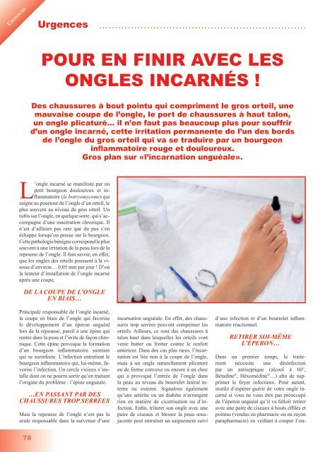 POUR EN FINIR AVEC LES ONGLES INCARNÉS !