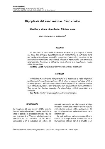 Hipoplasia del seno maxilar. Caso clínico