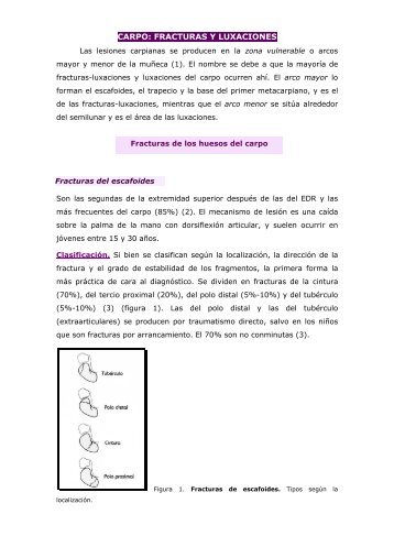 CARPO: FRACTURAS Y LUXACIONES