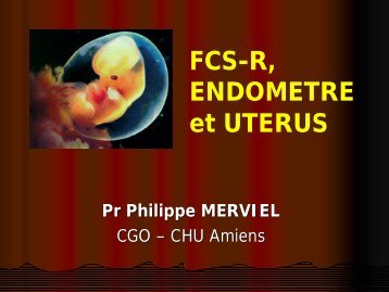 FCS récidivantes, endomètre et utérus - RAISOvo