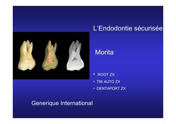 L'Endodontie sécurisée Morita