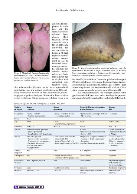 123-130 - synth - morand - Revue Médecine Tropicale