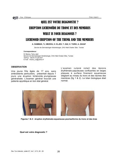 QUEL EST VOTRE DIAGNOSTIC ? ERUPTION LICHENOÏDE DU ...