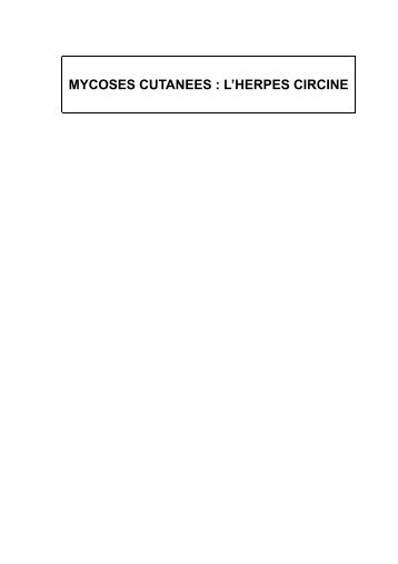 MYCOSES CUTANEES : L'HERPES CIRCINE - MedQual