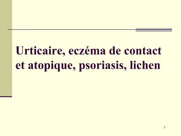 Urticaire, eczéma de contact et atopique, psoriasis, lichen - ammppu