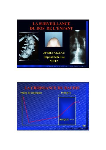 LA SURVEILLANCE DU DOS DE L'ENFANT LA ... - ammppu