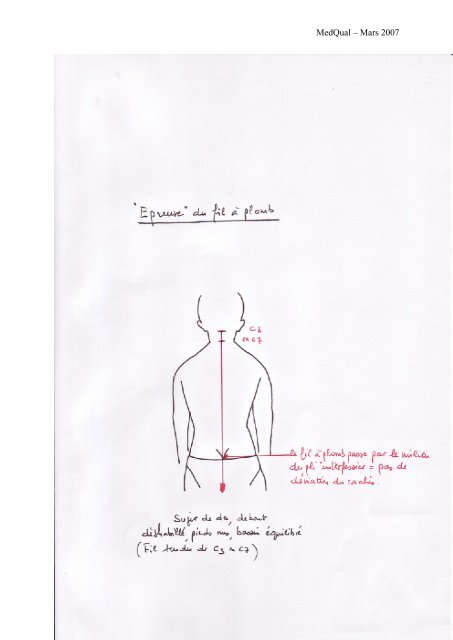 Attitude scoliotique ou Scoliose de l enfant - MedQual